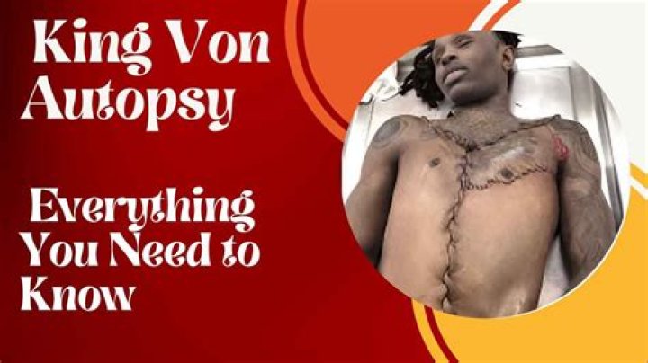 Unveiling The Autopsy Findings Of The Late King Von